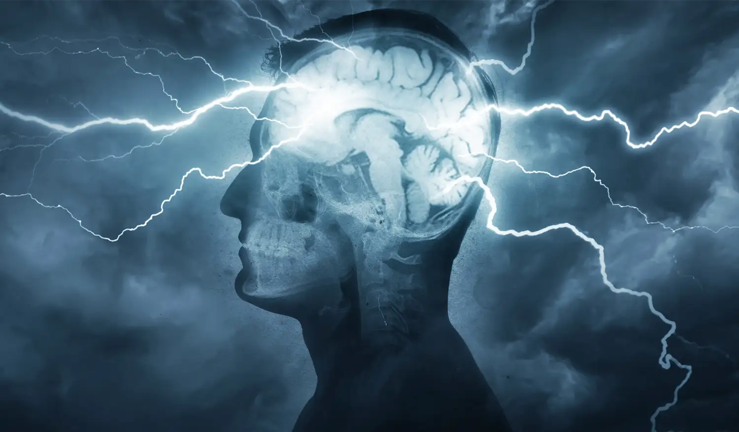 The Silent Assault on Our Brain: Are We Doomed to a Mass Brain Meltdown?